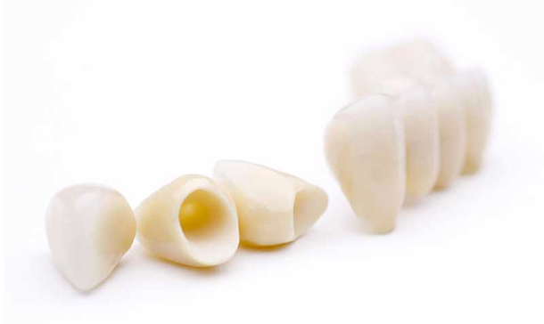 Естетичне протезування зубів: безметалева кераміка на оксиді цирконію