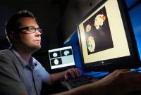 Ученые доказали улучшение памяти при электрической стимуляции мозга