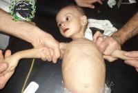 У Сирії помирають люди від голоду