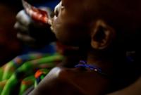 ООН: 1,4 миллиону детей в Африке и на Ближнем Востоке грозит голодная смерть