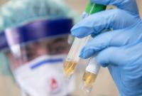 На Буковине за сутки обнаружили 30 случаев коронавируса, в общем - уже 409