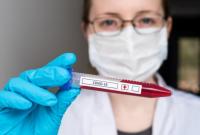 В Херсонской области зафиксировали 345 новых случаев коронавируса в сутки