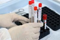 В Чернигове подтвердили случаи инфицирования "Дельта"-штамом коронавируса
