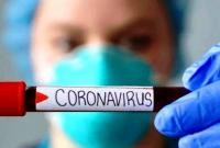 На Херсонщине зафиксировали 29 новых случаев коронавируса в сутки