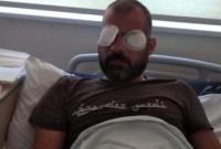 В Грузии избитый противниками ЛГБТ-марша журналист говорит, что ослеп на один глаз