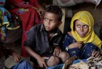 Голод загрожує 41 мільйону людей у світі – ООН