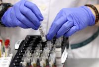 На Херсонщине зафиксировали 127 новых случаев коронавируса в сутки