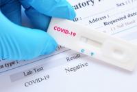 Минздрав советует делать тест на коронавирус при любых признаках простуды