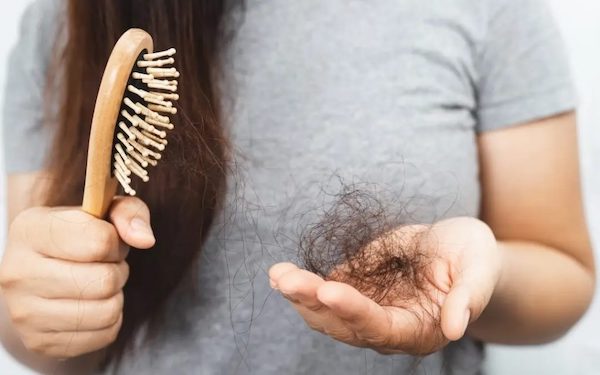 Выпадение волос: причины и способы лечения