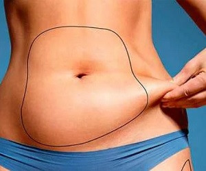 Жир на животе - как он влияет на ваше здоровье