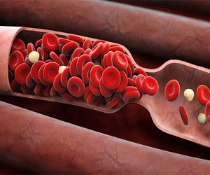 Густая кровь: как восстановить качество крови