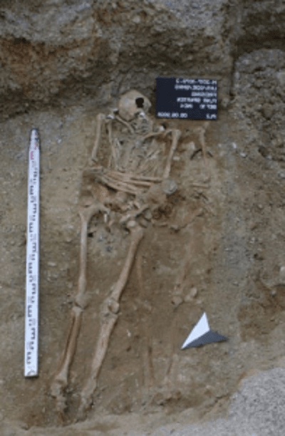 Археологи нашли скелет с протезом руки, которому может быть около 600 лет
