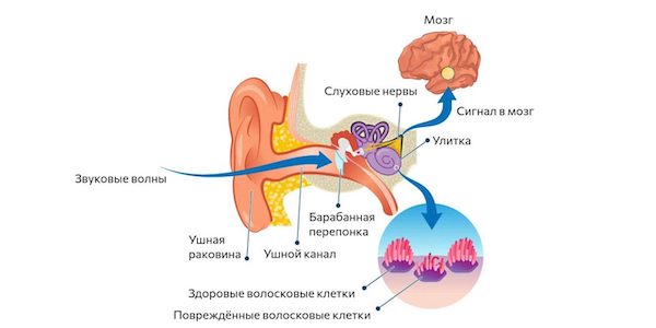 Как избавиться от звона в ушах и причины его появления